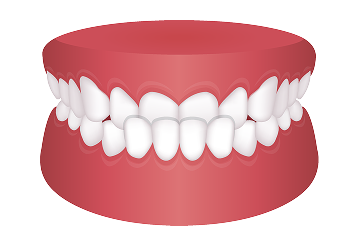 orthodontics_image06