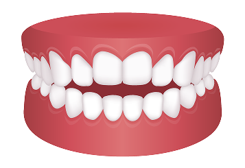 orthodontics_image08